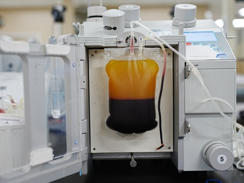 After being in the centrifuge machine for a few minutes, a bag of blood is placed on the plasma expressor to separate plasma, platelets and red blood cells.